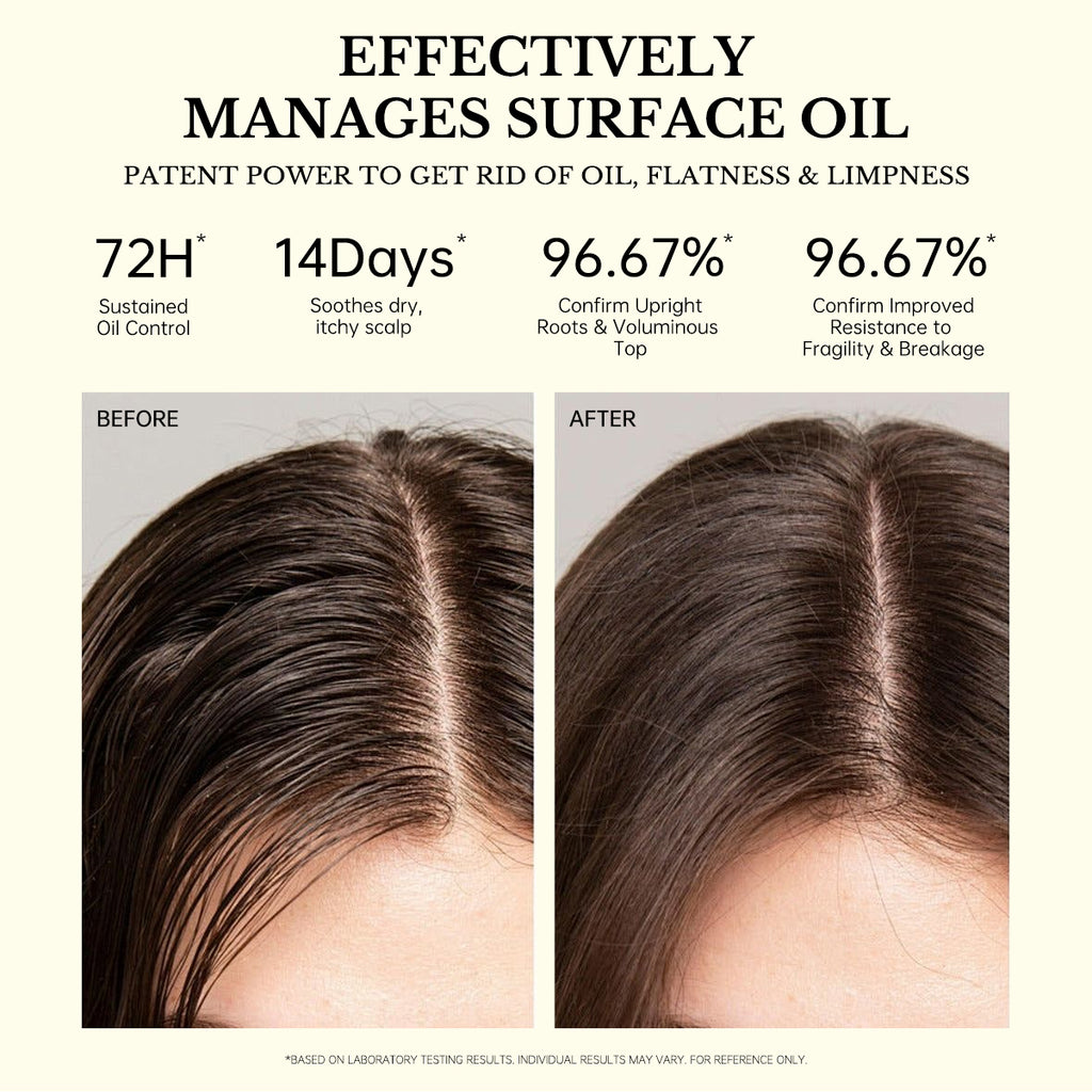FIC'PRO Ginger Scalp Care Shampoo - Anti-Hair Loss & Strengthening Formula for Thinning Hair
